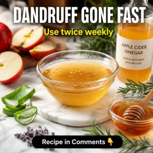 Dandruff Gone Fast: Five Natural Scalp Remedies Based on Scalp Type